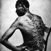 The Scars Of Slavery