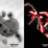 How 'microbial dark matter' might cause disease