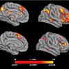Cannabis Consumers Show Greater Susceptibility to False Memories