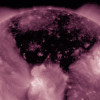 Huge Coronal Hole Opens on the Sun
