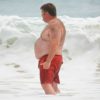 Obesity Fattens US Health Care Costs Up by 29%, Varies by State